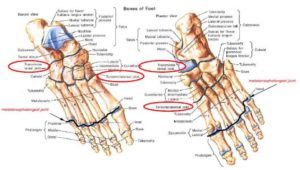 MTP Foot Joint